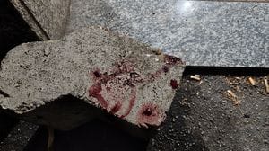 Codogno, dimesso il 32enne ferito alla gola con un coccio di bottiglia